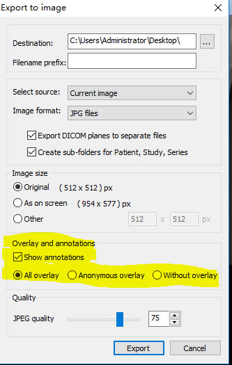 MicroDicom°桿MicroDicom(ҽѧͼ)° v3.4.7 pc