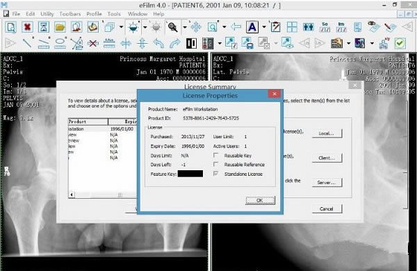 efilm3.4؄edEFilm(tWD̎ܛ) v3.4 ؄e棨עԴa