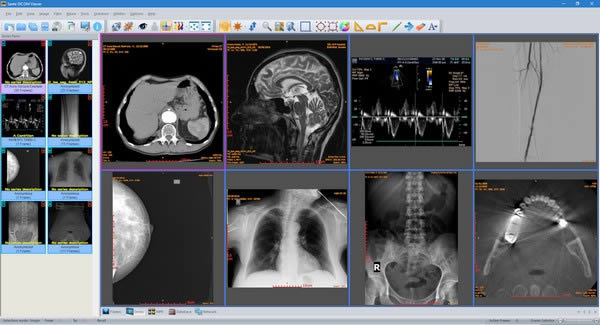 Sante DICOM Viewer-ҽư칫-Sante DICOM Viewer v11.8.6ٷ汾