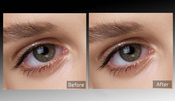 Retouch4me Eye Vessels-ͼƬ-Retouch4me Eye Vessels v0.9.9.3ٷ汾